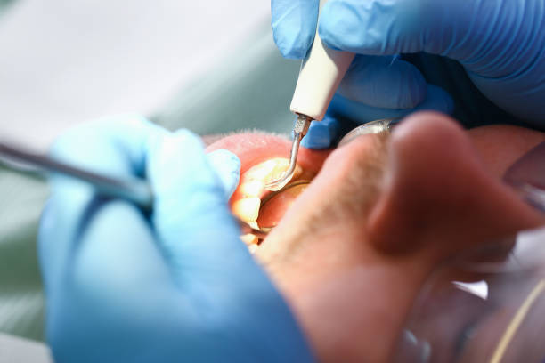 Best Emergency Dental Care for Trauma or Injury in Hawkinsville, GA