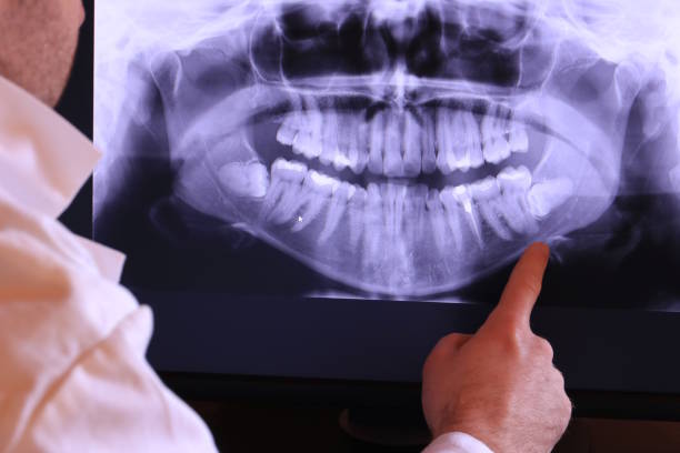 Best Emergency Tooth Extraction in Hawkinsville, GA
