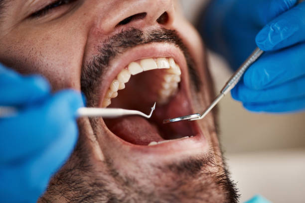 Best Emergency Tooth Extraction in Hawkinsville, GA